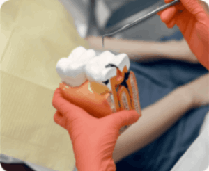 Root Canal Treatment